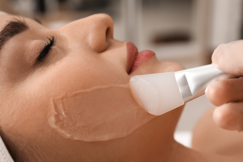 Chemical Peel
