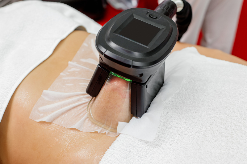 Cryolipolysis (Fat Freezing Technology)