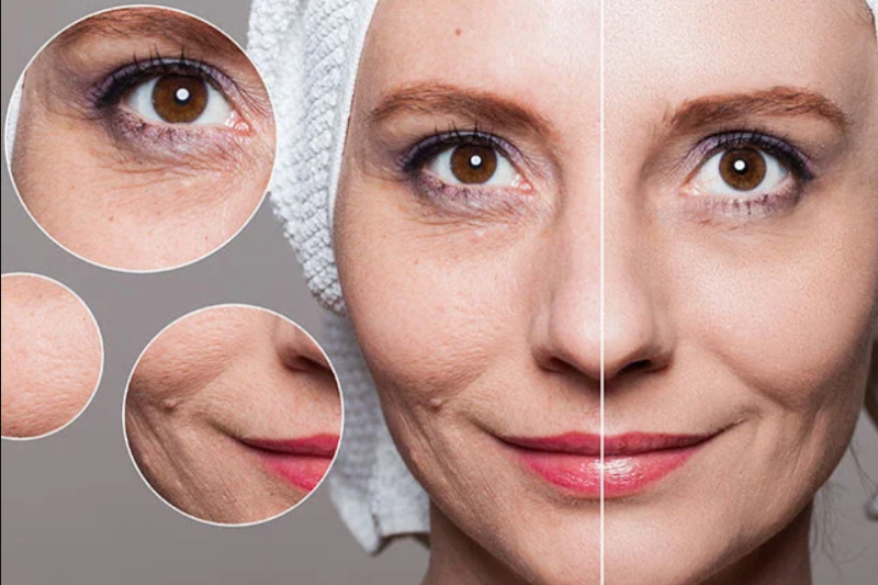 Tightening and Toning